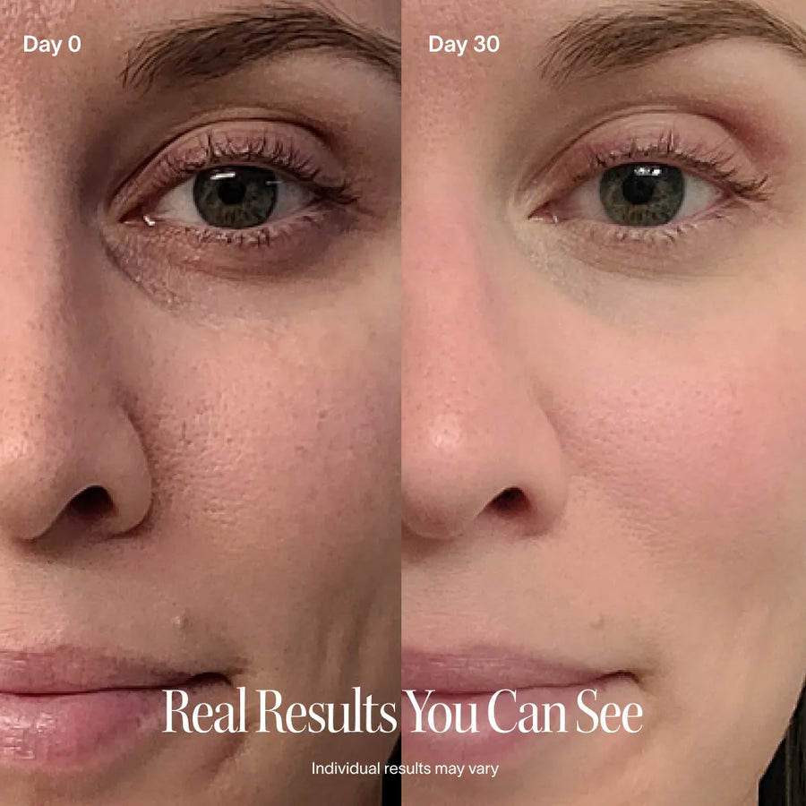Solawave skincare wand results